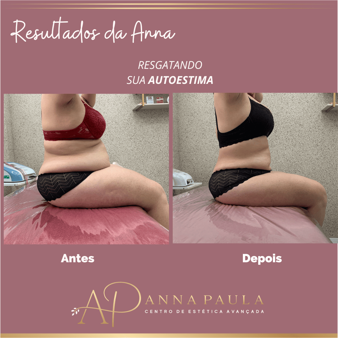 Resultado real de paciente em protocolo personalizado